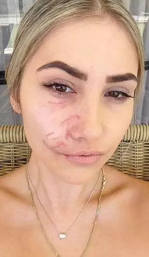 美女模特在澳惨遭恶犬袭击半张脸被咬烂