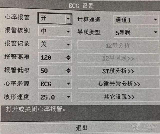 心电监护仪报警:常见原因有哪些?如何设置?