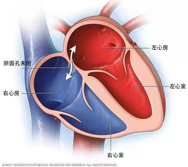 房间隔 解剖图片