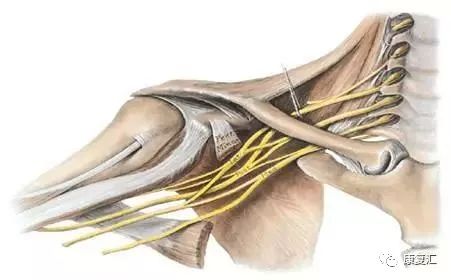 臂丛神经 康复专家总结