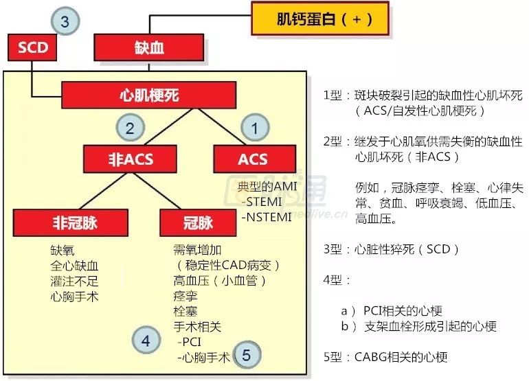 关于肌钙蛋白3张图4个重要问题一定要掌握