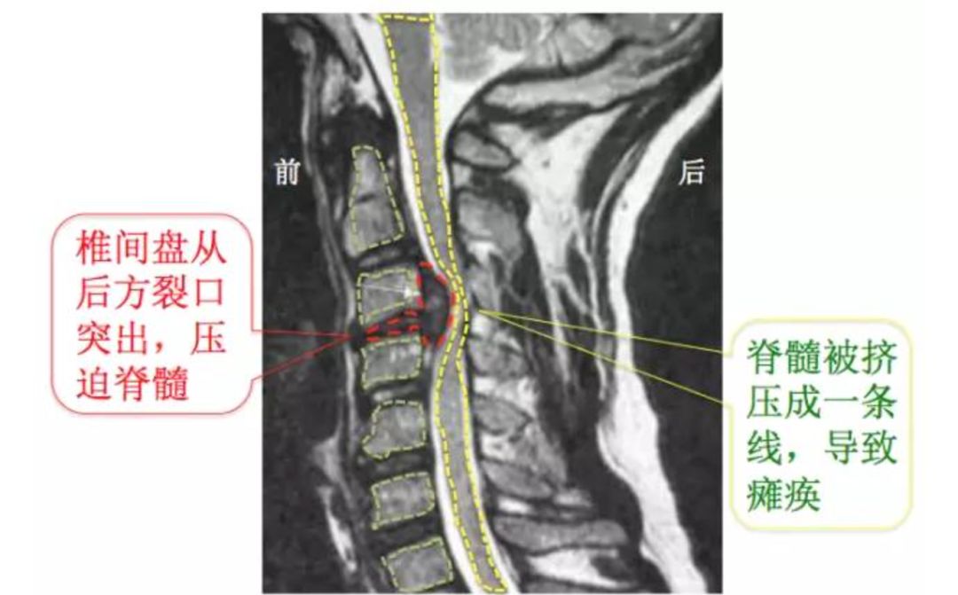 又一个低头族出事了,背后的原因让人不寒而栗