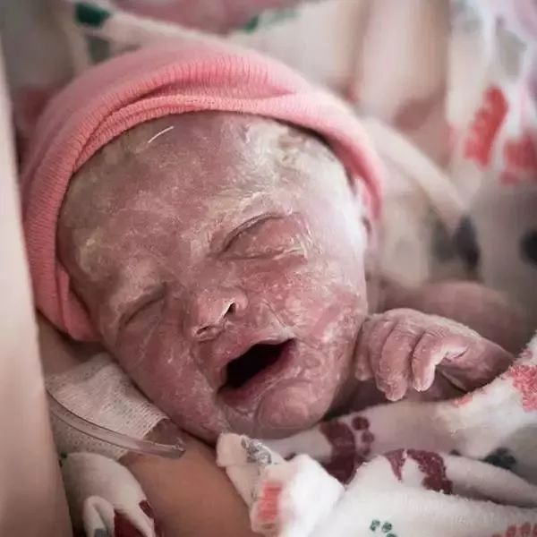 刚出生一天的婴儿照片图片