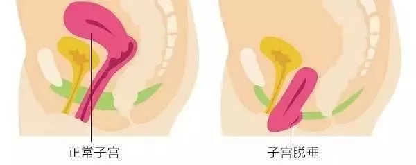 七块爱情肌的分布图图片