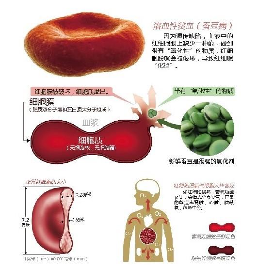 男性蚕豆病遗传规律图图片