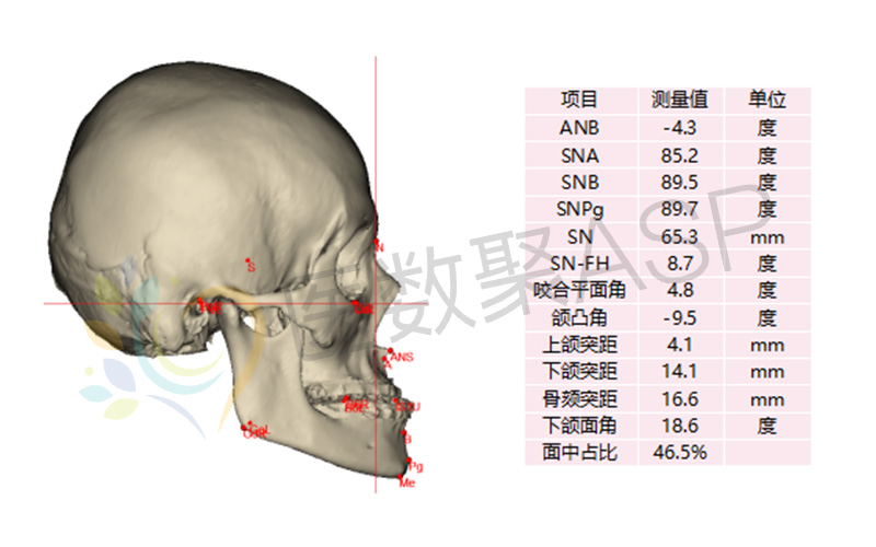 醫數聚asp對患者頭顱進行三維重建和全面精準的數據測量