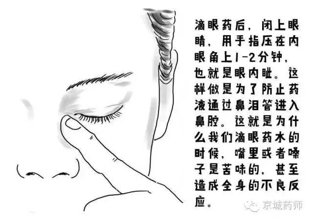 2)正确方法是:洗净手,后仰头,拉开下眼睑,眼药水滴入结膜囊