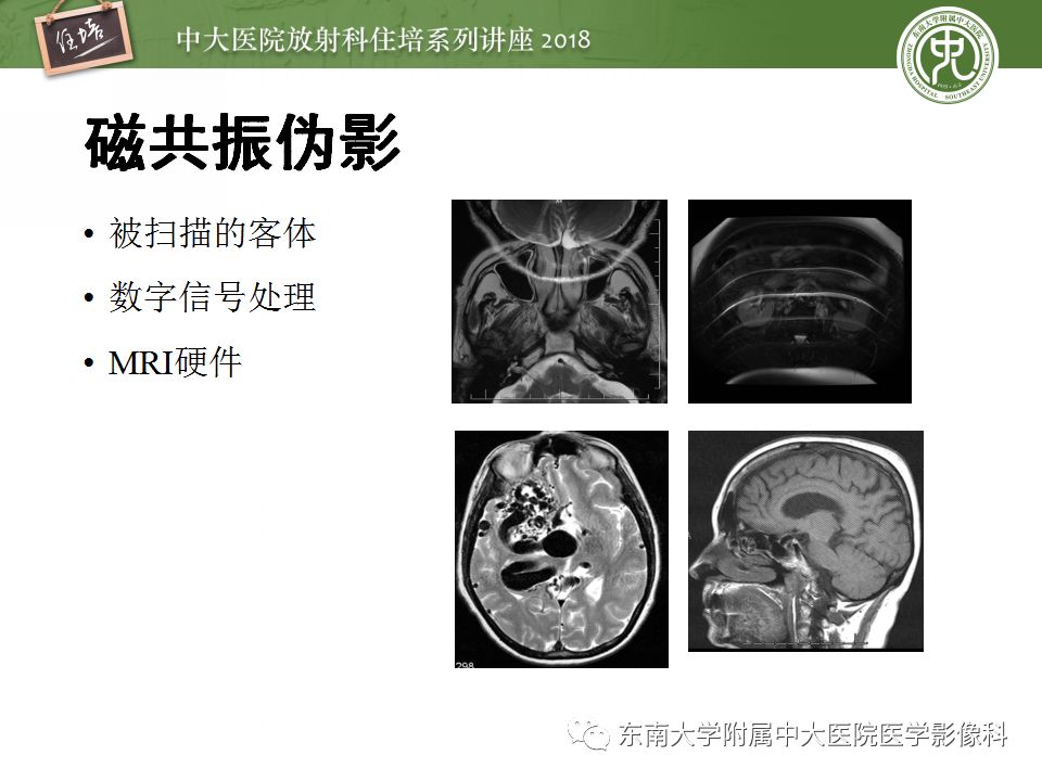 科技 正文 來源:東南大學附屬中大醫院醫學影像科 《高分辨率肺部ct》