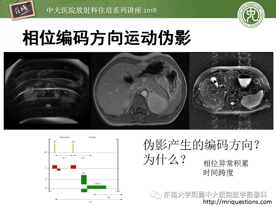 磁共振成像常见伪影