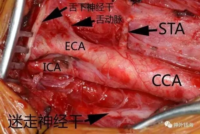 鸡的颈部血管分布图图片