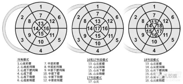 左心室分段图解图片