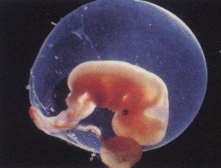 7周的胎儿图片图片