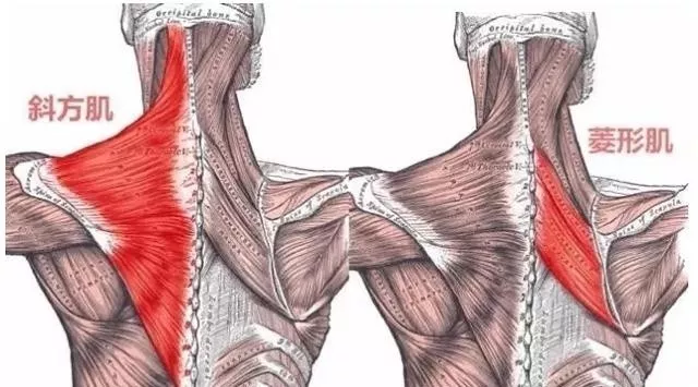 菱形肌 背部疼痛的主要原因 附锻炼方法