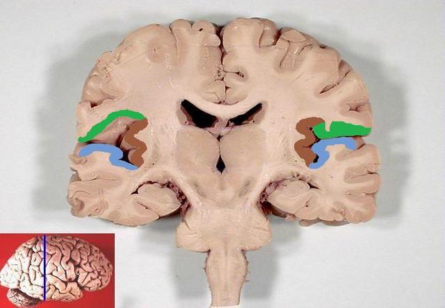 偷走愛因斯坦大腦的瘋狂醫生,究竟研究出了什麼呢?