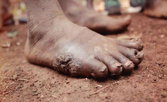 非洲砍手砍脚事件图片