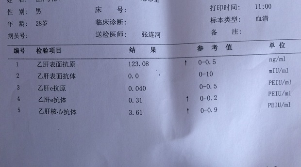 如果某人的血液中表面抗原,核心抗體和e抗原顯示為陽性,那麼就可以