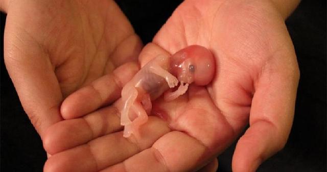 堕胎胎儿图片图片