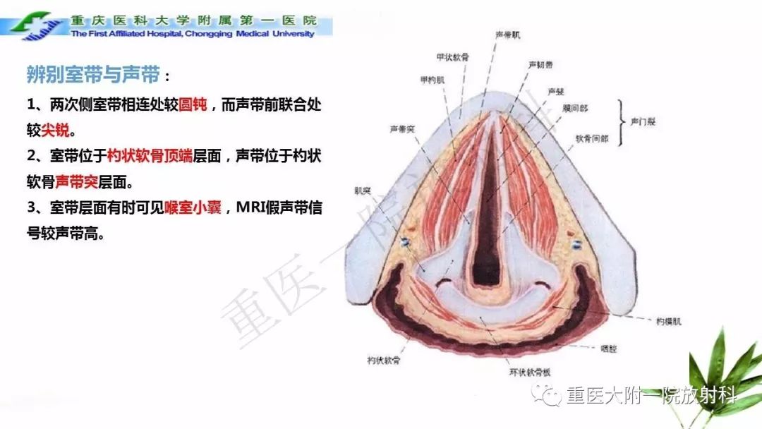 喉室带图片
