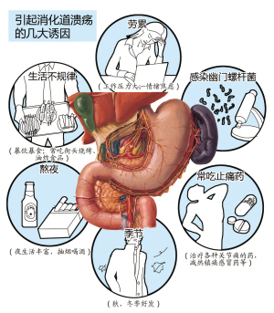 十二指肠溃疡不用怕