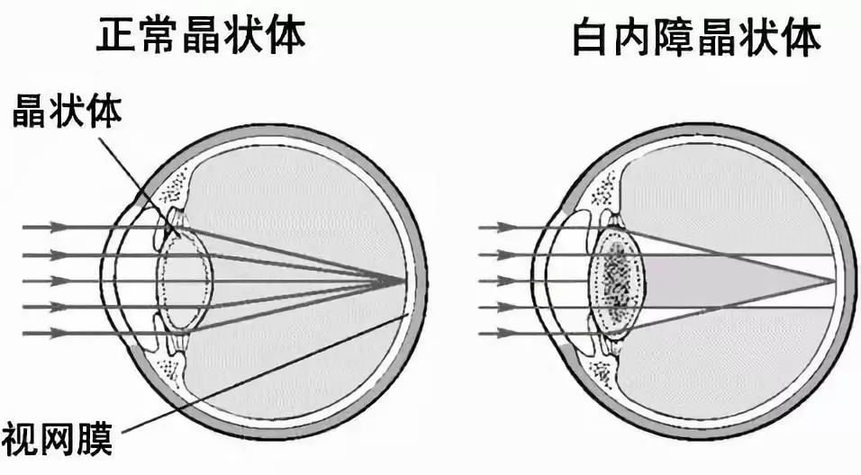 眼睛晶体结构图片大全图片