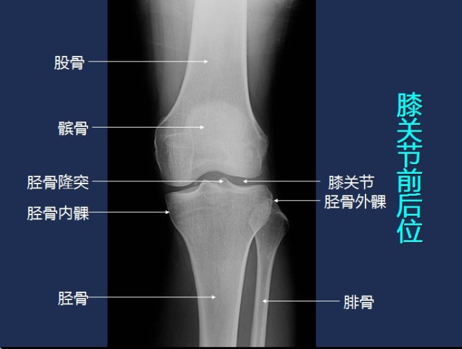 股骨x线解剖图片