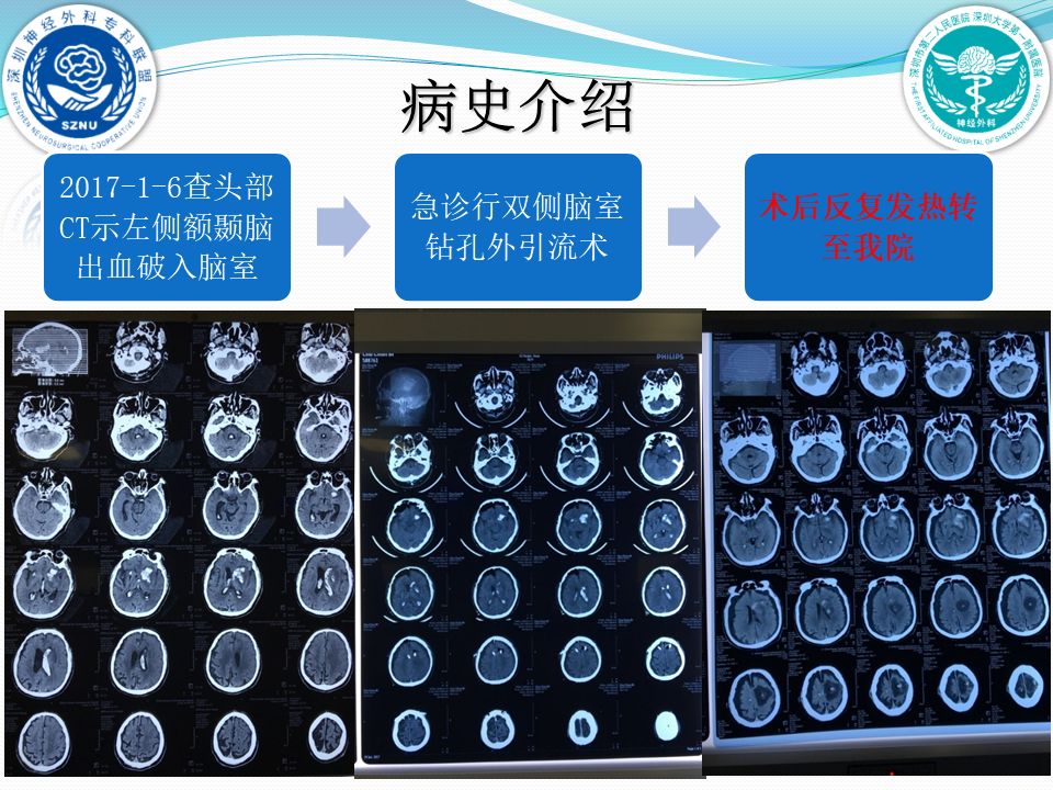 大学第一附属医院脑科中心神经重症与创伤病区黄贤键,高杰,马宇强