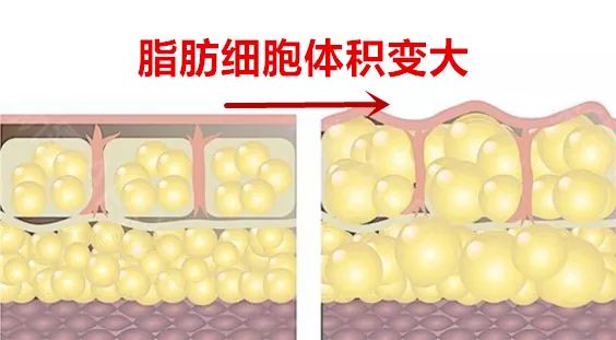 脂肪细胞数量(@图片来自网络)而溶脂针是通过成分中的磷脂酰胆碱其实