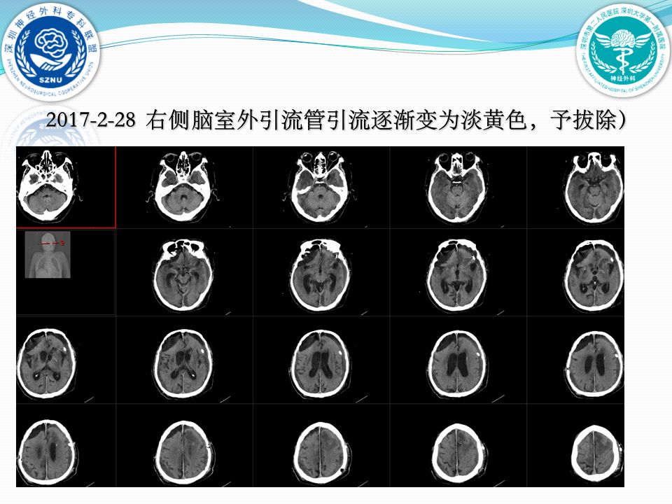 大学第一附属医院脑科中心神经重症与创伤病区黄贤键,高杰,马宇强