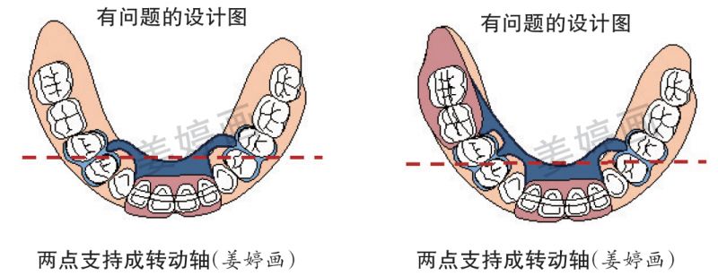 舌隆突的位置图片图片