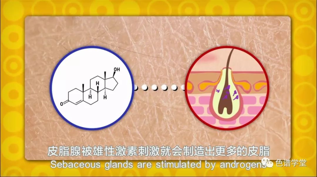 皮脂腺被雄性激素刺激就会制造出更多的皮脂