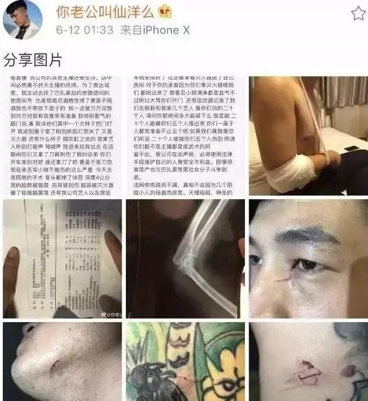 仙洋發出受傷圖片!面部毀容,眼受重創 曝事發細節,放出狠話