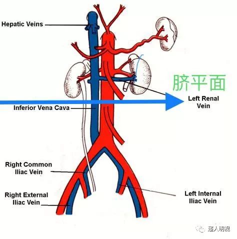 脐动脉位置图片