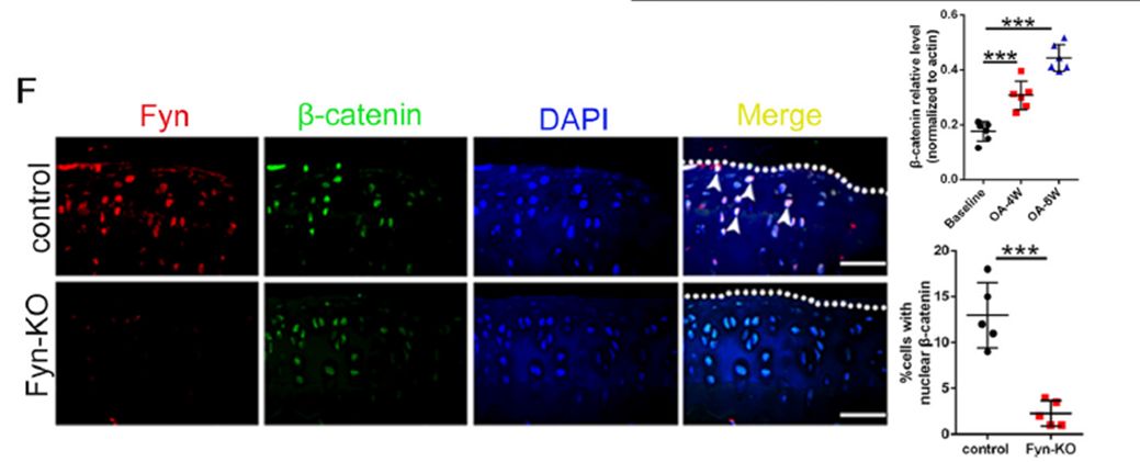 南方醫科大學白曉春組發現酪氨酸激酶fyn可以通過激活βcatenin通路