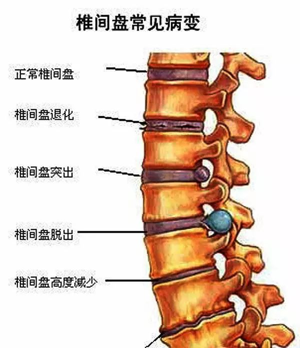 胸椎颈椎腰椎骨棘突定位图文详解