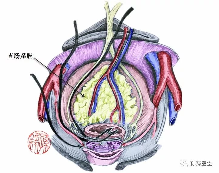 醫學筆記|立體理解直腸癌根治手術的三個層面(附:彩色圖譜)