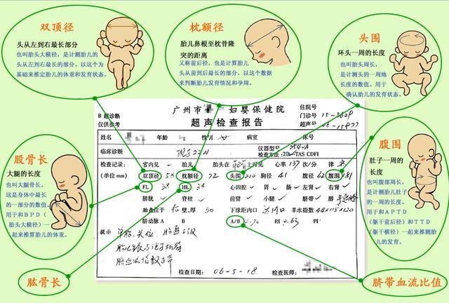 枕额径(ofd:胎儿鼻根至枕骨