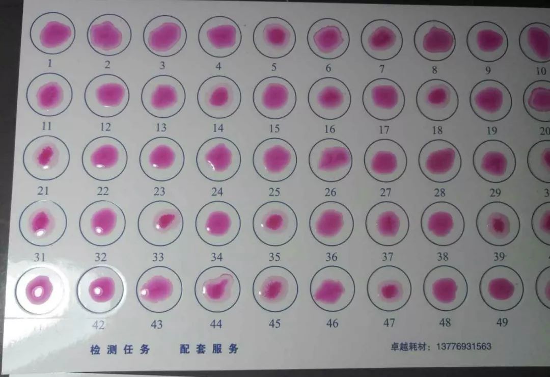 布病检测卡两道杠图片图片