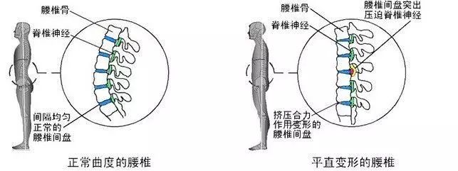 腰部前屈后伸示意图图片