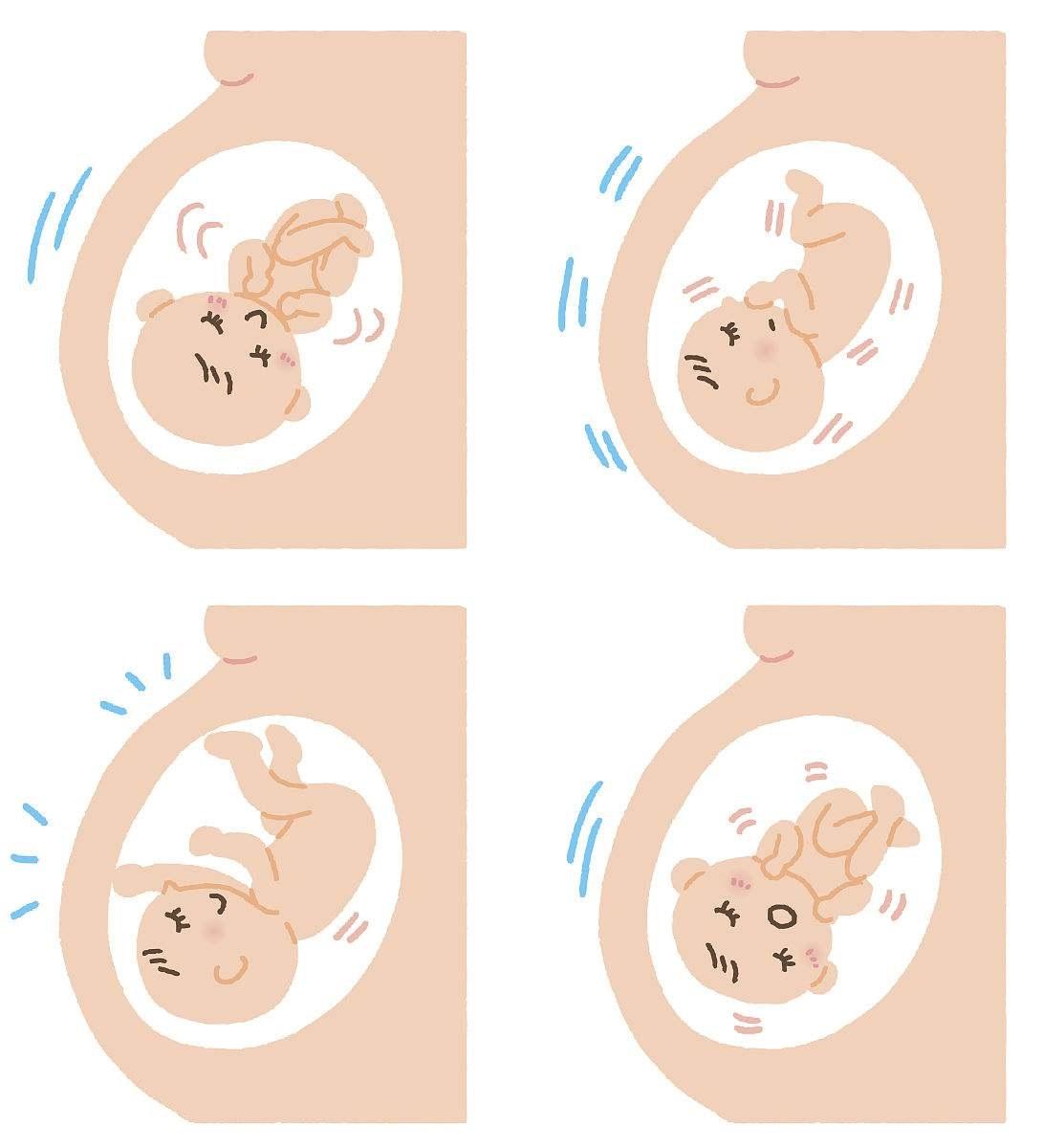 胎动示意图图片