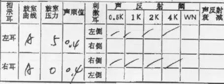 镫骨肌声反射正常值图图片