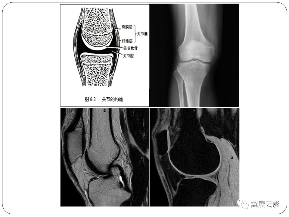 经典回顾膝关节影像解剖及损伤诊断
