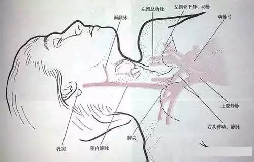 脖子放血的位置示意图图片