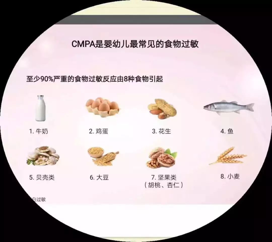 宝宝过敏妈妈饮食回避多久(宝宝过敏妈妈饮食回避多久会好)-第1张图片-鲸幼网