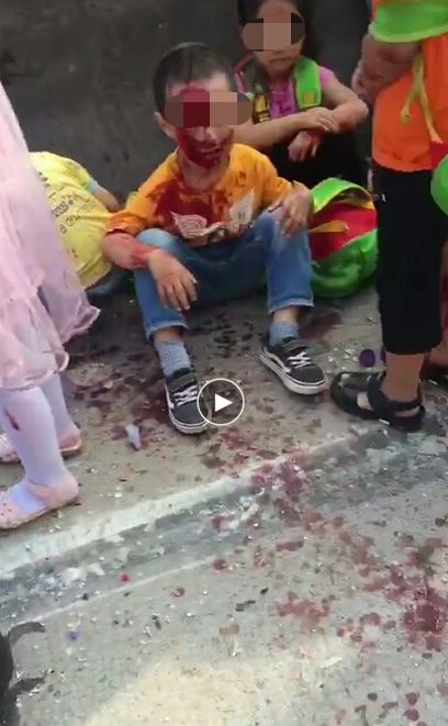 十多个孩子受伤!安徽一校车发生交通事故!