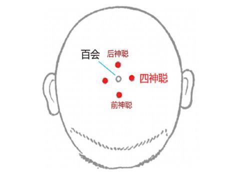 手法:四神聪穴位于头顶部,百会穴前后左右各1寸处,共4个穴位