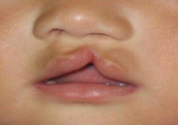 孕妇几乎每天,都在做这件事,才导致孩子刚出生嘴巴就是兔唇!
