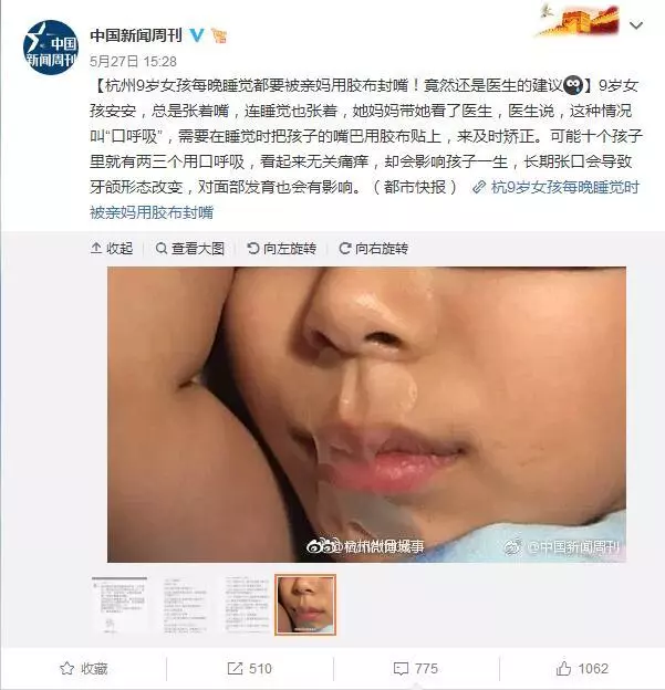 milk唐迷被一個新聞嚇到,《杭州9歲女孩每晚睡覺都要被親媽用膠布封嘴