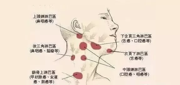 颈部淋巴结位置分布图图片