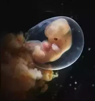 孕8周胎儿真实图图片