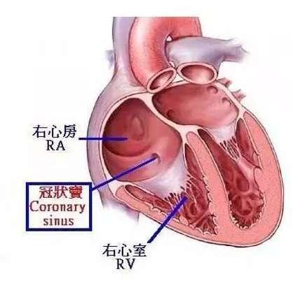 房室束与希氏束图片